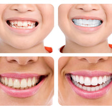 Last inn bildet i Galleri-visningsprogrammet, Magic Smile Tannskinne