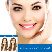 Last inn bildet i Galleri-visningsprogrammet, Magic Smile Tannskinne