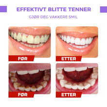 Last inn bildet i Galleri-visningsprogrammet, Tannfargekorrigerende serum