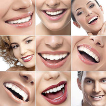 Last inn bildet i Galleri-visningsprogrammet, Magic Smile Tannskinne