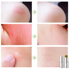 Last inn bildet i Galleri-visningsprogrammet, Kløestillende beroligende Comfrey-salve