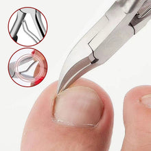 Last inn bildet i Galleri-visningsprogrammet, Spikerspor olecranon klipper i rustfritt stål