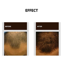 Last inn bildet i Galleri-visningsprogrammet, Fast Natural Hair Growth Spray, 30ml