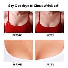 Last inn bildet i Galleri-visningsprogrammet, Anti Wrinkle-Reusable Silicone Care Chest Pad