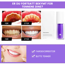 Last inn bildet i Galleri-visningsprogrammet, Tannfargekorrigerende serum
